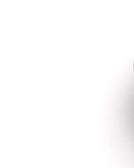 All Balls Front Wheel Spacer Kit